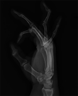 6.1