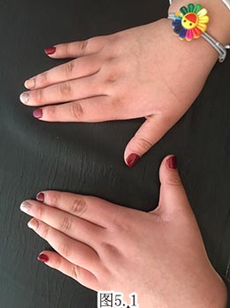 图5.1